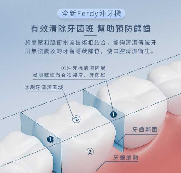 強強滾~【美國FerdY】美國佛迪家用型沖牙機