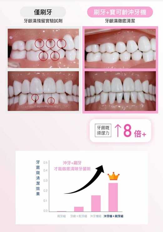 新莊 PORClean 寶可齡 THIN601 隨身型抗菌沖牙機(櫻花粉) 洗牙 牙線 手持
