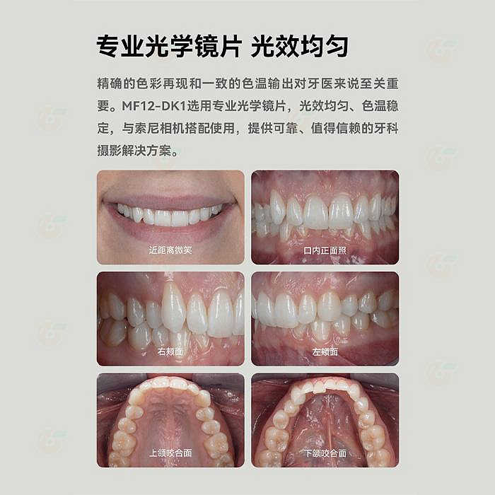 神牛 Godox MF12-DK1 DK2 DK3 微距閃光燈 牙醫閃燈套組 公司貨 牙科攝影 口腔拍照 環閃 MF12